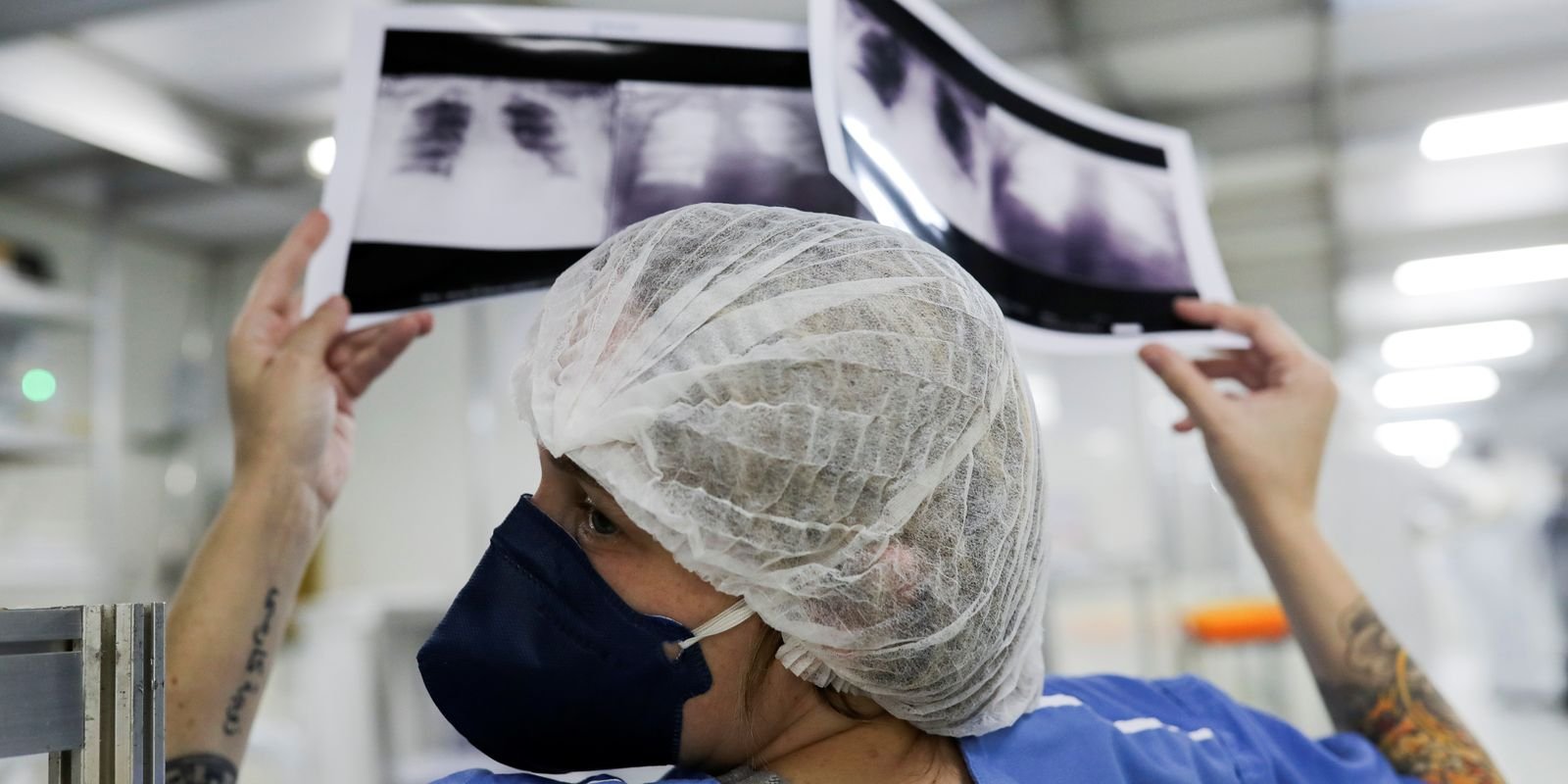 Lei institui campanha para conscientização sobre câncer de pulmão